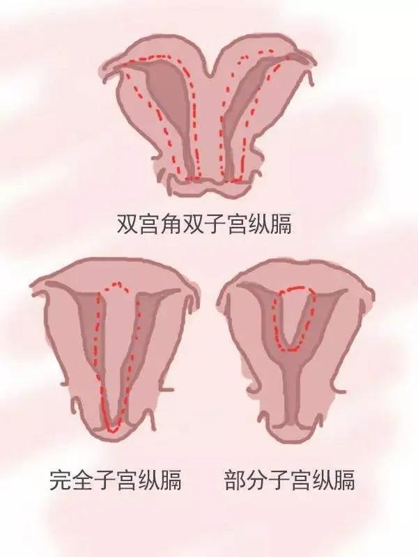 为什么胎停育越来越多 这5大原因让人防不胜防